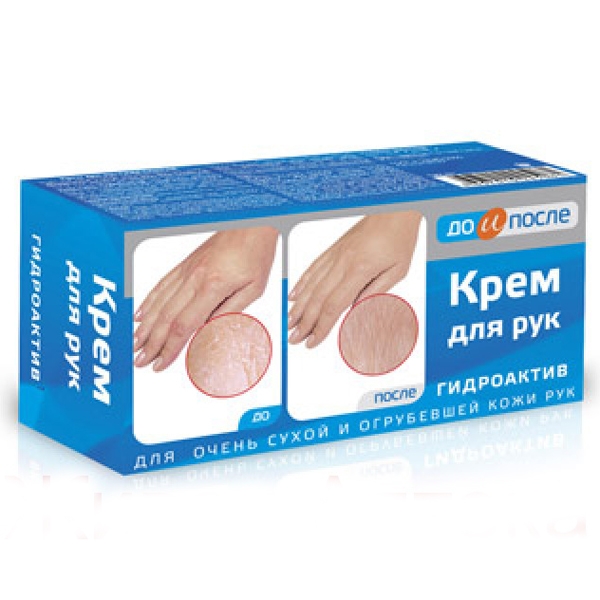 До и После,крем д/рук Гидроактив д/сухой и огруб кожи 100мл